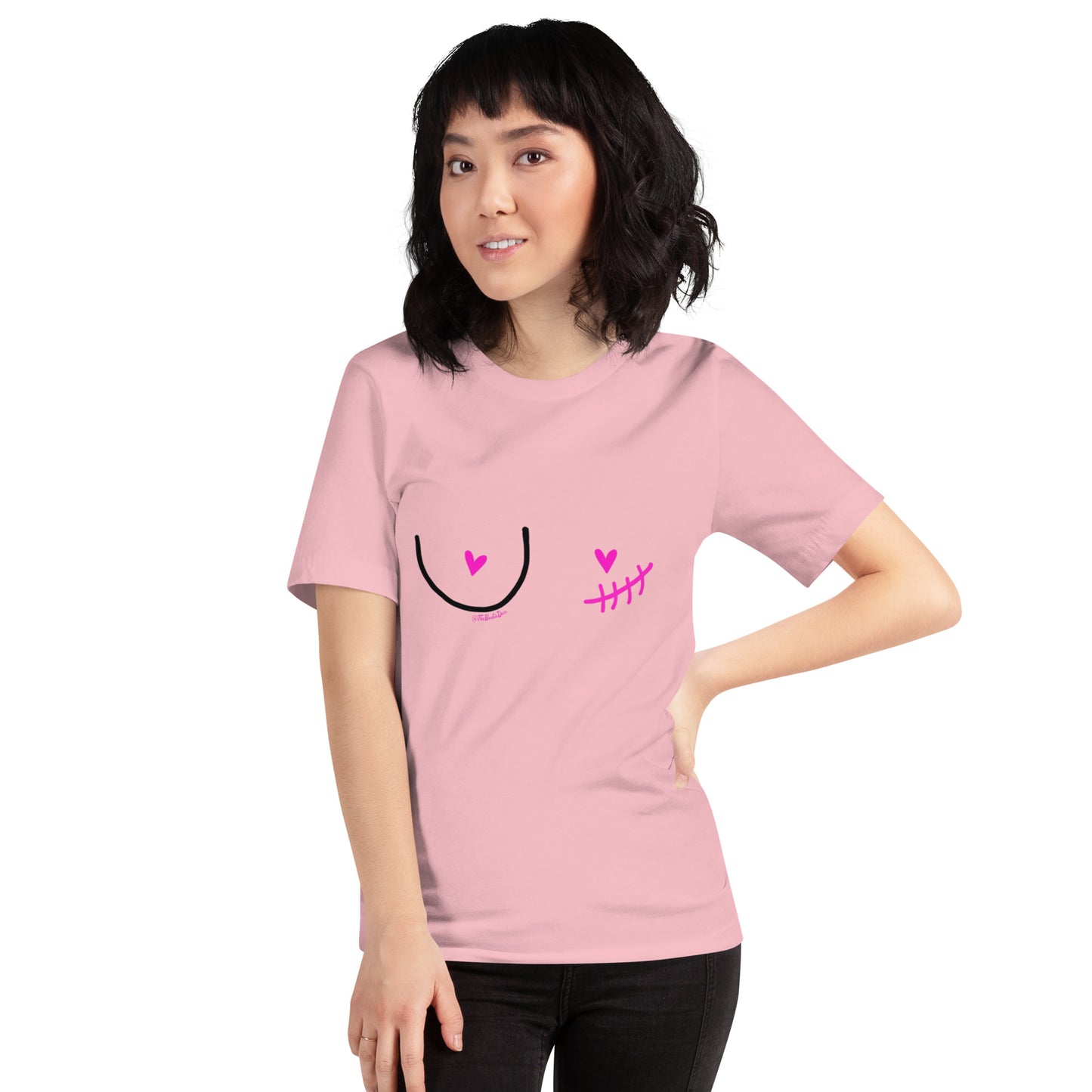 nipple sparing mastectomy left