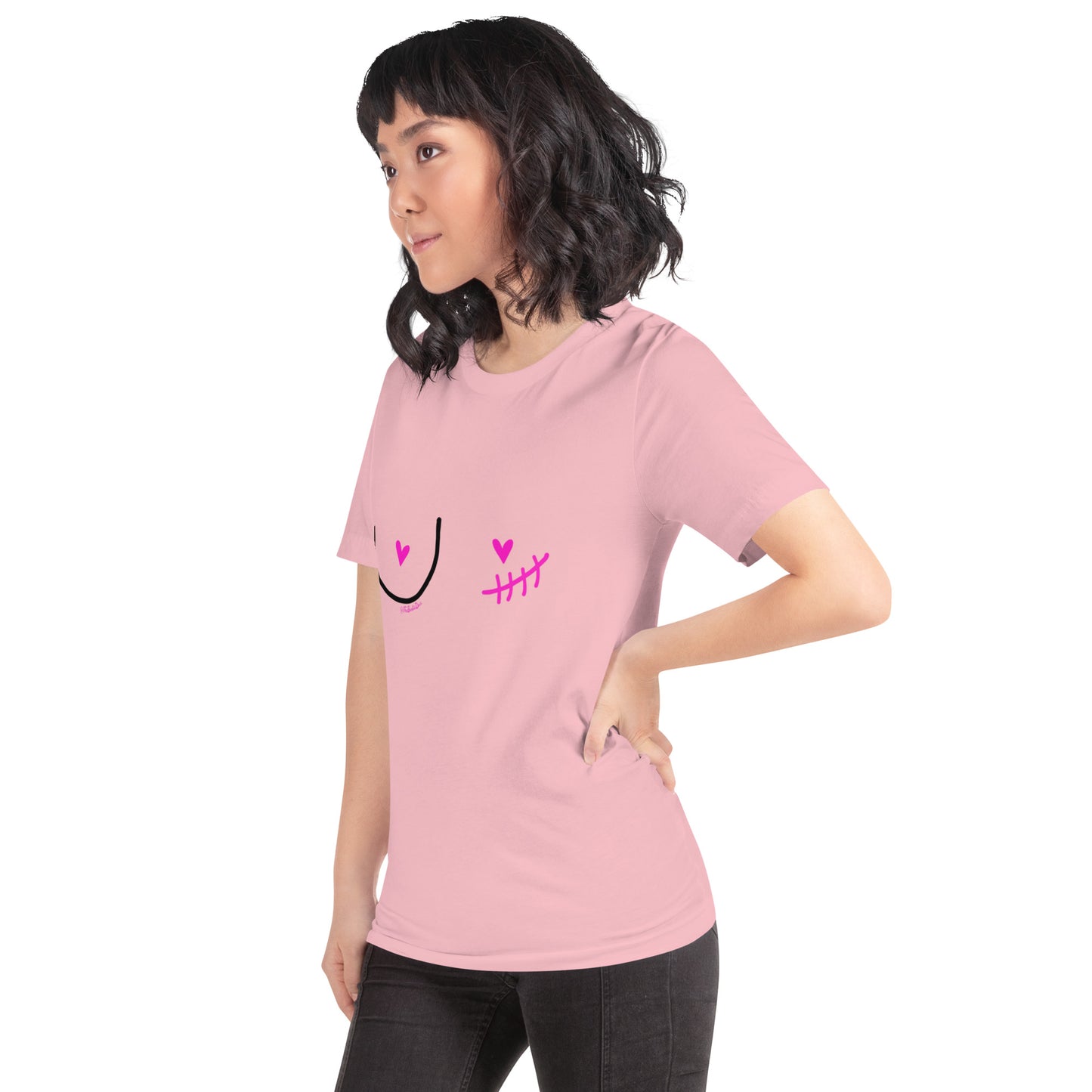 nipple sparing mastectomy left