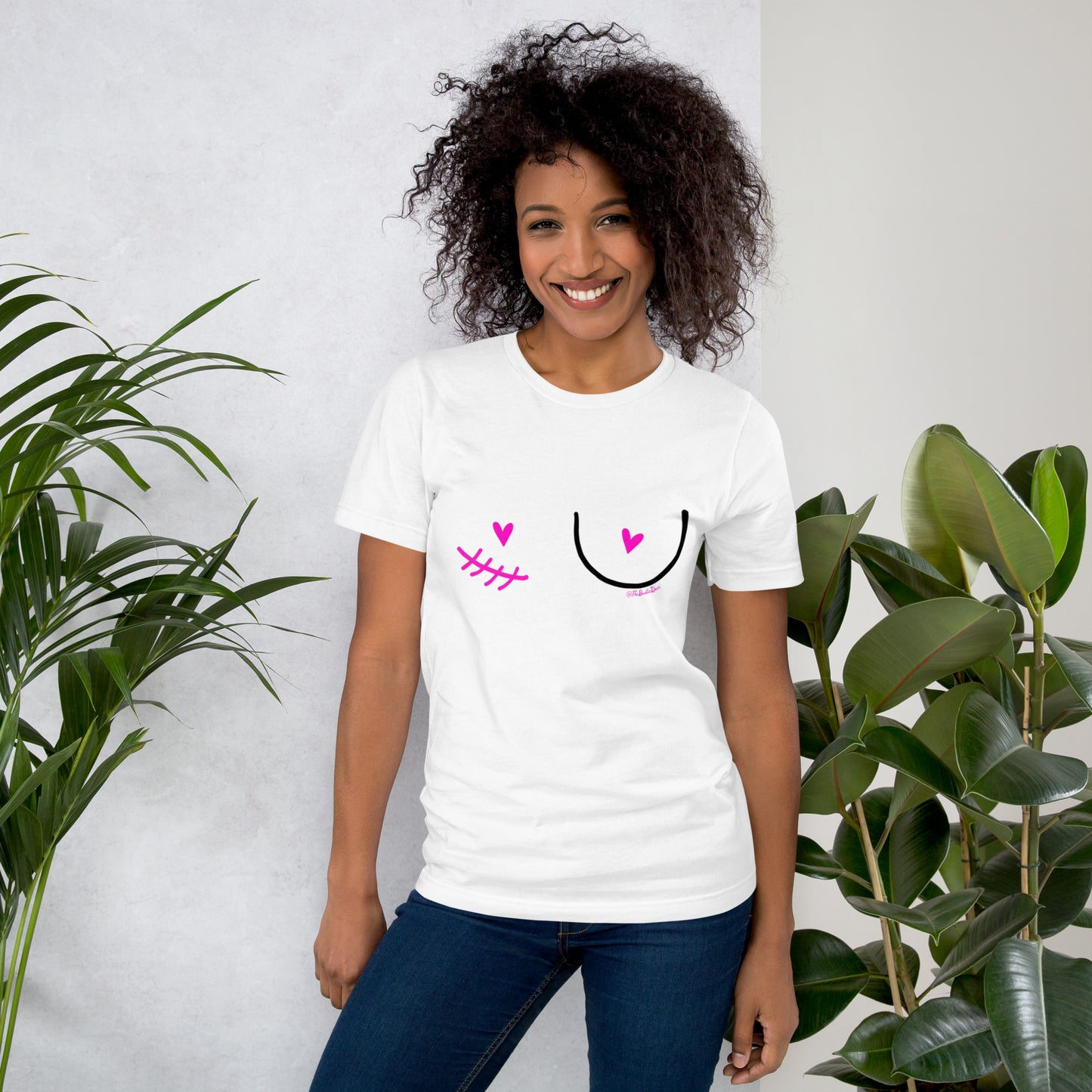 nipple sparing mastectomy right