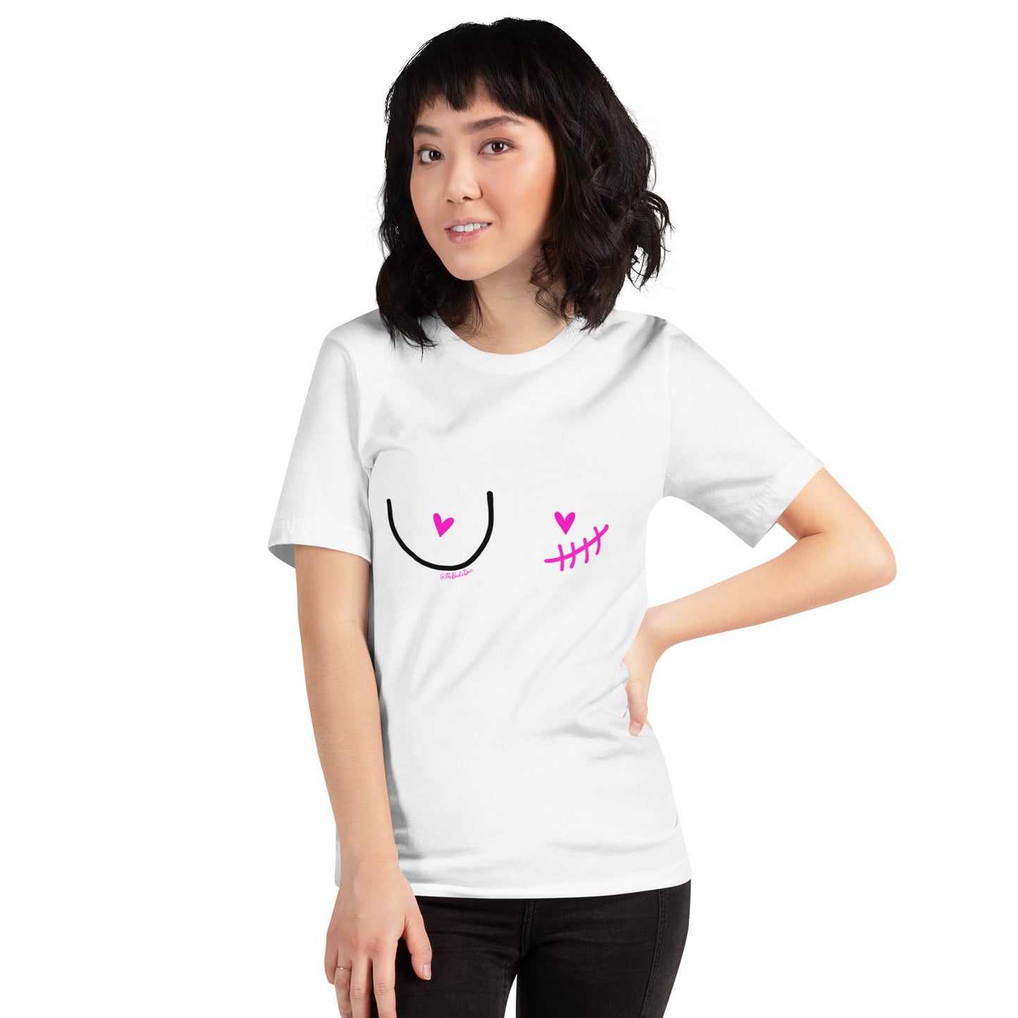nipple sparing mastectomy left