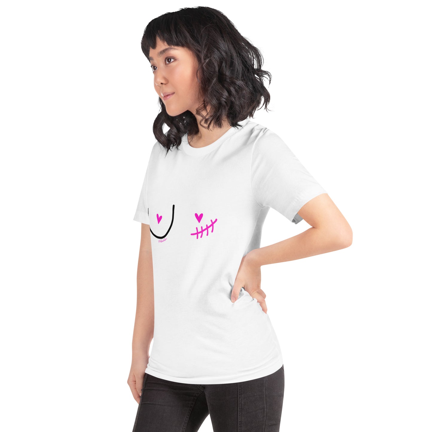 nipple sparing mastectomy left