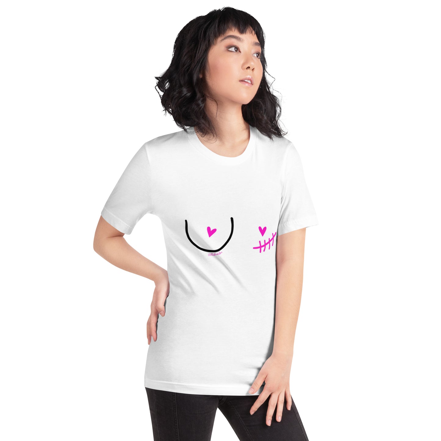 nipple sparing mastectomy left